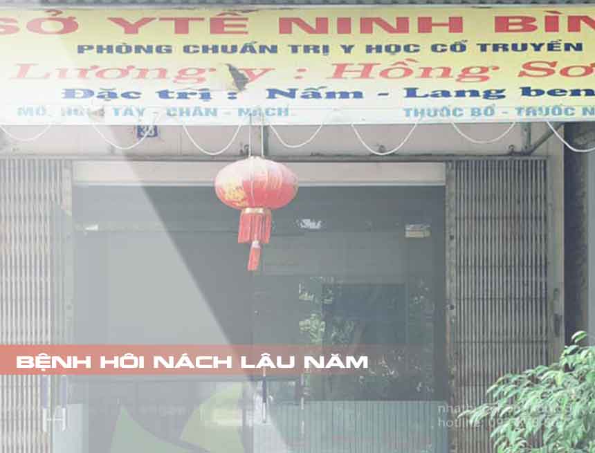 Chữa Hôi Nách Ở Đâu Tốt? Cách Chữa Hôi Nách Tại Nhà Nhanh Nhất